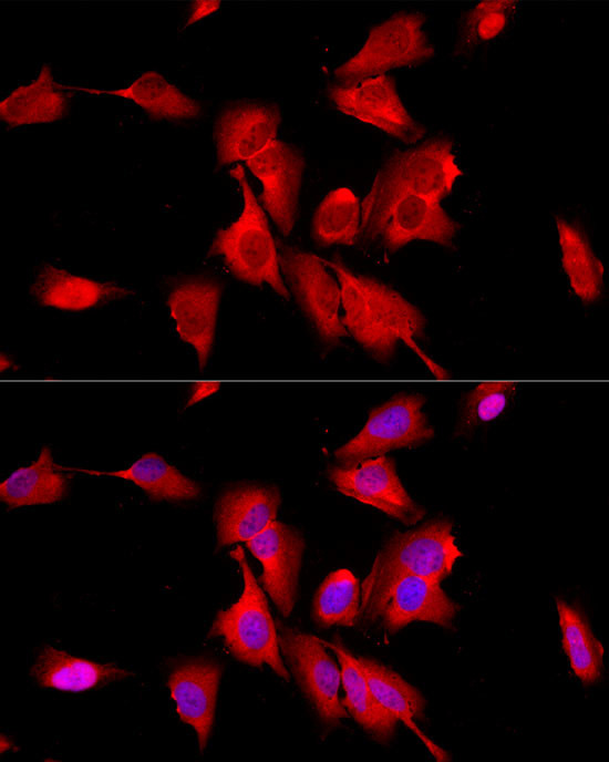 NSE Antibody in Immunocytochemistry (ICC/IF)