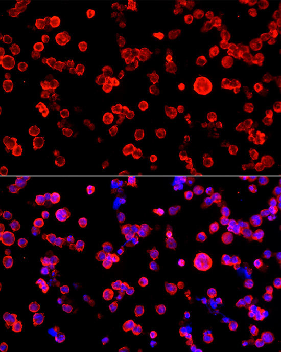 NSE Antibody in Immunocytochemistry (ICC/IF)