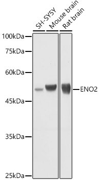 NSE Antibody in Western Blot (WB)