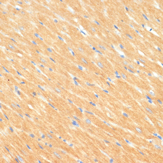 MYBPC3 Antibody in Immunohistochemistry (Paraffin) (IHC (P))