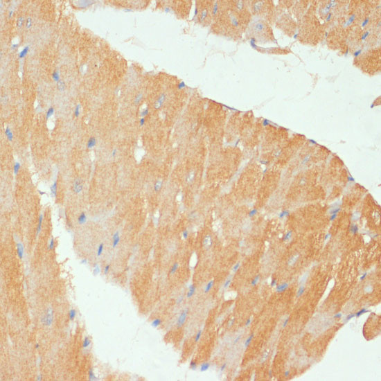 MYBPC3 Antibody in Immunohistochemistry (Paraffin) (IHC (P))