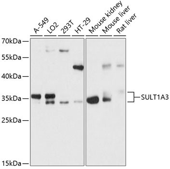 SULT1A3 Antibody in Western Blot (WB)