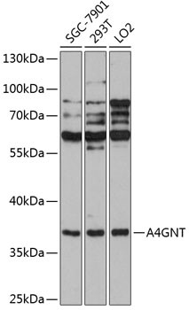 A4GNT Antibody in Western Blot (WB)