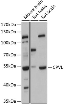 CPVL Antibody in Western Blot (WB)