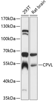 CPVL Antibody in Western Blot (WB)