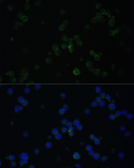 CD3d Antibody in Immunocytochemistry (ICC/IF)