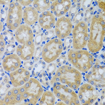 Acid Phosphatase 1 Antibody in Immunohistochemistry (Paraffin) (IHC (P))