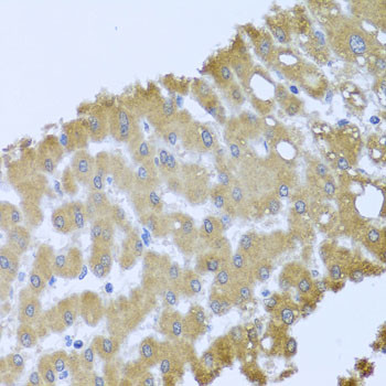 Acid Phosphatase 1 Antibody in Immunohistochemistry (Paraffin) (IHC (P))