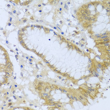 Acid Phosphatase 1 Antibody in Immunohistochemistry (Paraffin) (IHC (P))