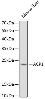 Acid Phosphatase 1 Antibody in Western Blot (WB)