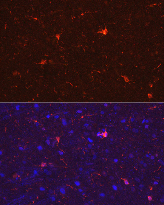 IBA1 Antibody in Immunocytochemistry (ICC/IF)