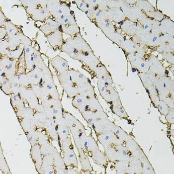 Annexin A2 Antibody in Immunohistochemistry (Paraffin) (IHC (P))