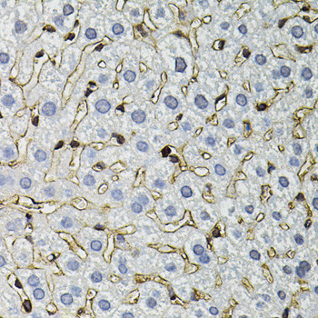 Annexin A2 Antibody in Immunohistochemistry (Paraffin) (IHC (P))