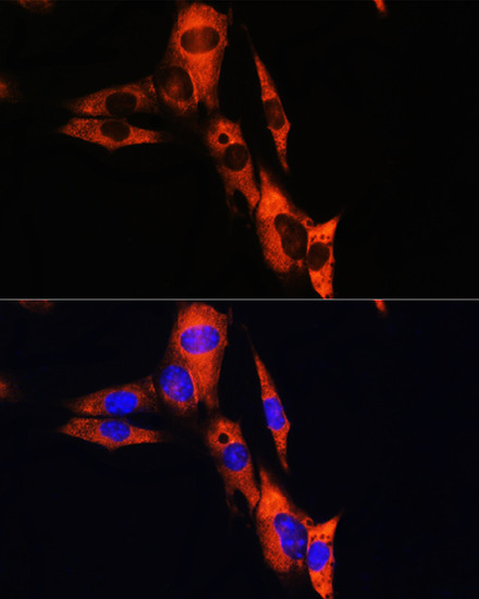 ATP1B1 Antibody in Immunocytochemistry (ICC/IF)