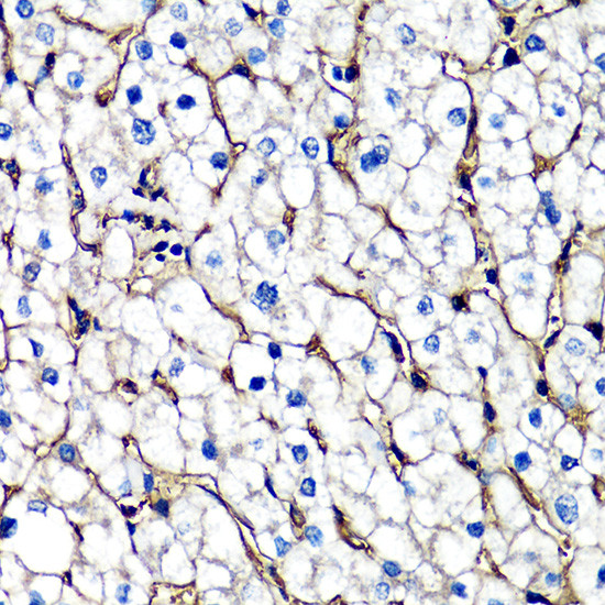 beta-2 Microglobulin Antibody in Immunohistochemistry (Paraffin) (IHC (P))