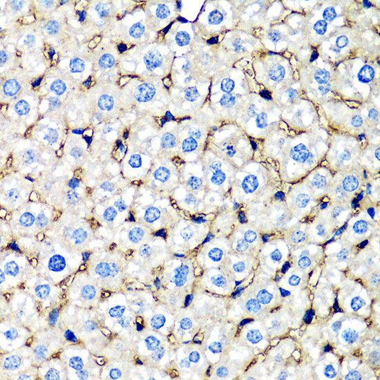 beta-2 Microglobulin Antibody in Immunohistochemistry (Paraffin) (IHC (P))