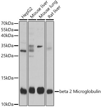 beta-2 Microglobulin Antibody in Western Blot (WB)