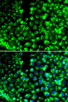 Calumenin Antibody in Immunocytochemistry (ICC/IF)