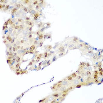 CDK1 Antibody in Immunohistochemistry (Paraffin) (IHC (P))