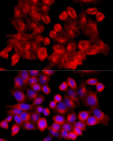 Clathrin Heavy Chain Antibody in Immunocytochemistry (ICC/IF)