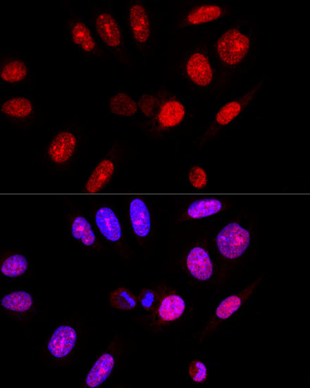 Ataxin 3 Antibody in Immunocytochemistry (ICC/IF)