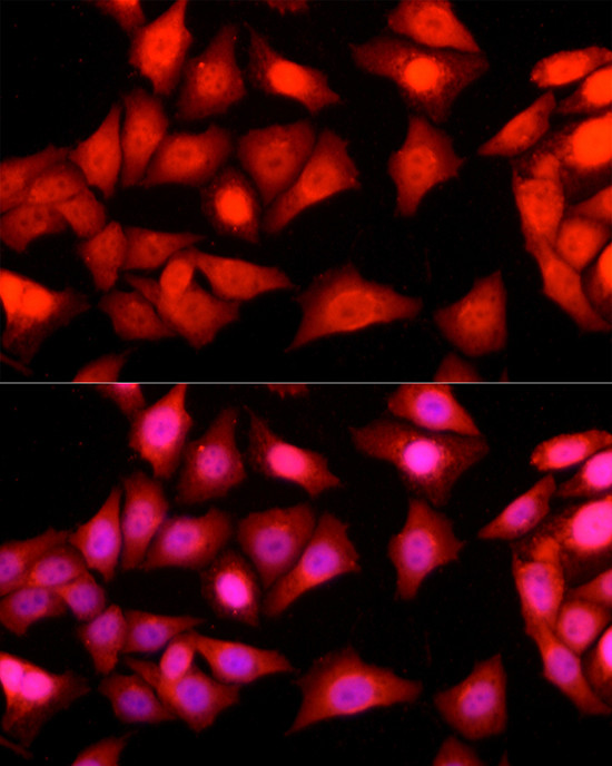 Ataxin 3 Antibody in Immunocytochemistry (ICC/IF)