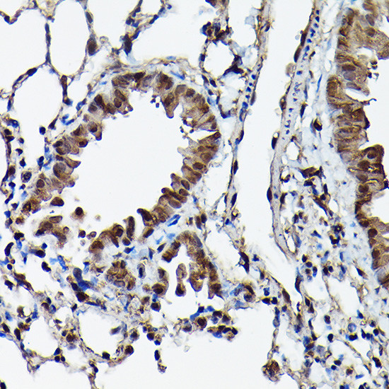 Ataxin 3 Antibody in Immunohistochemistry (Paraffin) (IHC (P))