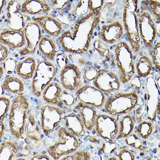 Ataxin 3 Antibody in Immunohistochemistry (Paraffin) (IHC (P))