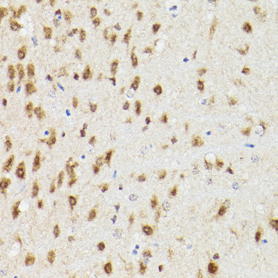 PSMA3 Antibody in Immunohistochemistry (Paraffin) (IHC (P))