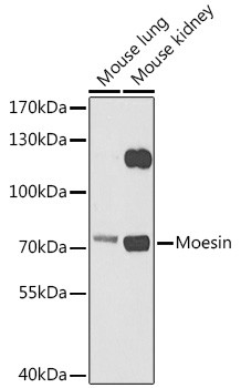 Moesin Antibody in Western Blot (WB)