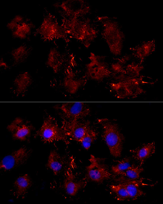 Moesin Antibody in Immunocytochemistry (ICC/IF)