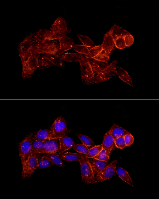 Moesin Antibody in Immunocytochemistry (ICC/IF)