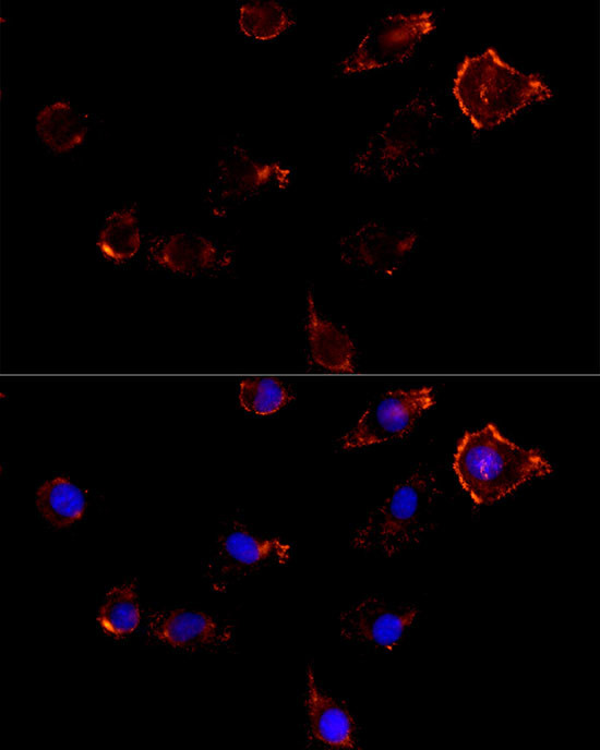 Moesin Antibody in Immunocytochemistry (ICC/IF)