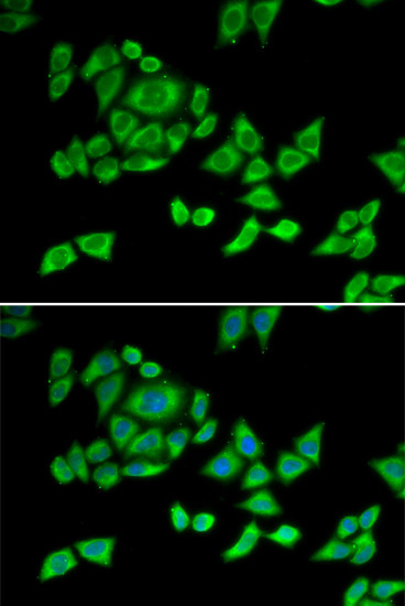 OGDH Antibody in Immunocytochemistry (ICC/IF)