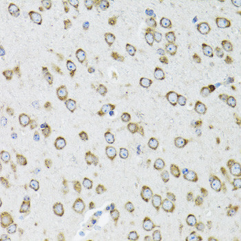 OGDH Antibody in Immunohistochemistry (Paraffin) (IHC (P))