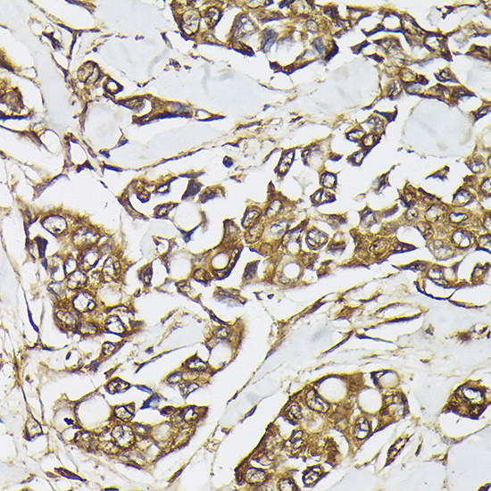 PIK3CA Antibody in Immunohistochemistry (Paraffin) (IHC (P))