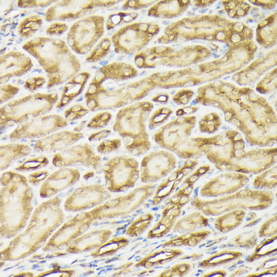 PIK3CA Antibody in Immunohistochemistry (Paraffin) (IHC (P))