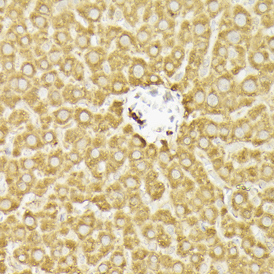 PIK3CA Antibody in Immunohistochemistry (Paraffin) (IHC (P))