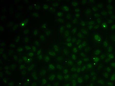 RAD51C Antibody in Immunocytochemistry (ICC/IF)