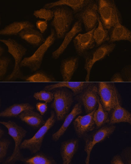 SHMT1 Antibody in Immunocytochemistry (ICC/IF)