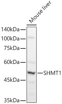 SHMT1 Antibody in Western Blot (WB)