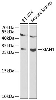 SIAH1 Antibody in Western Blot (WB)