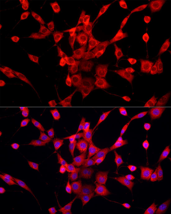 PEX5 Antibody in Immunocytochemistry (ICC/IF)