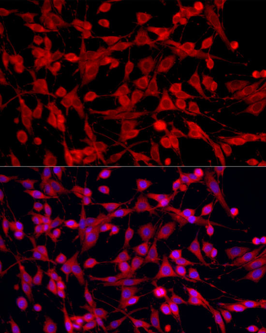 PEX5 Antibody in Immunocytochemistry (ICC/IF)