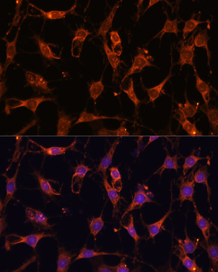 AKT2 Antibody in Immunocytochemistry (ICC/IF)