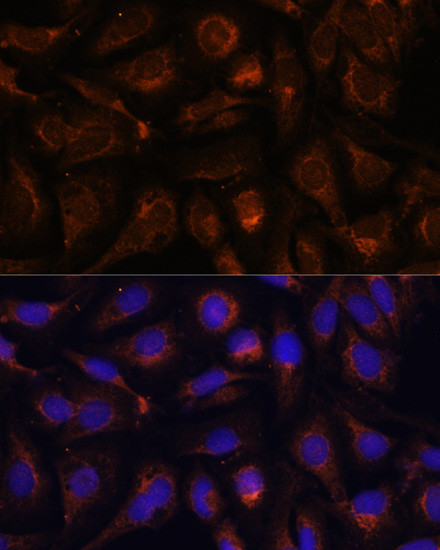 AKT2 Antibody in Immunocytochemistry (ICC/IF)