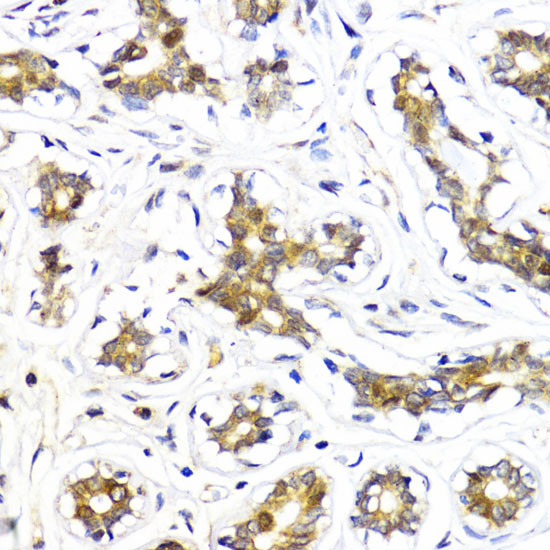 AKT2 Antibody in Immunohistochemistry (Paraffin) (IHC (P))