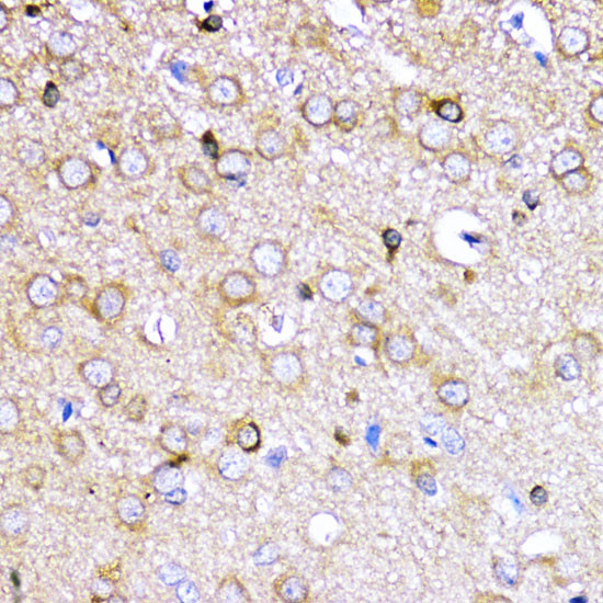 AKT2 Antibody in Immunohistochemistry (Paraffin) (IHC (P))