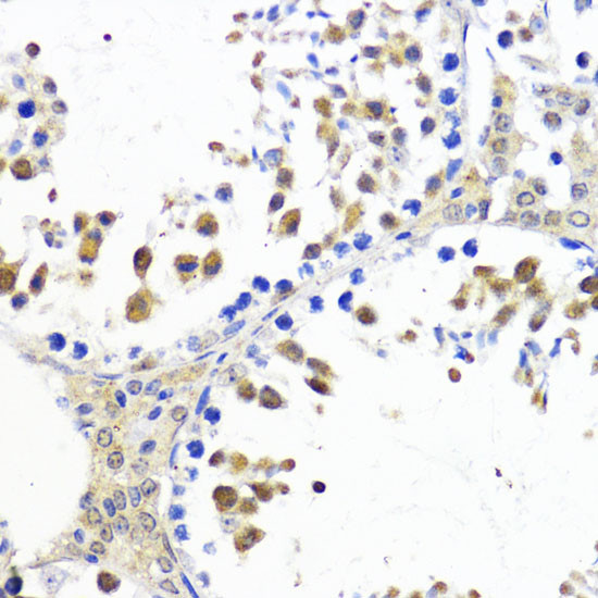 AKT2 Antibody in Immunohistochemistry (Paraffin) (IHC (P))