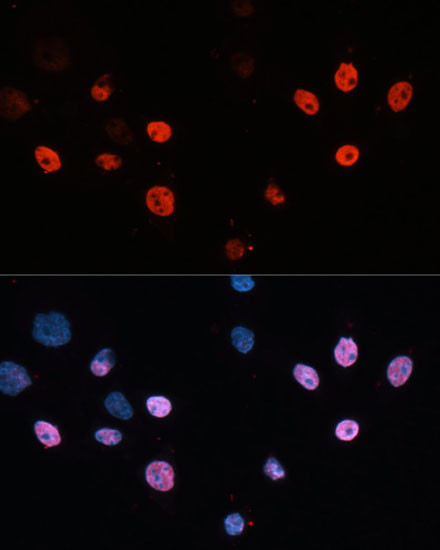 HDAC3 Antibody in Immunocytochemistry (ICC/IF)